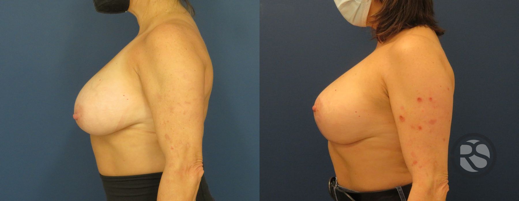 Before photo - Angle 3