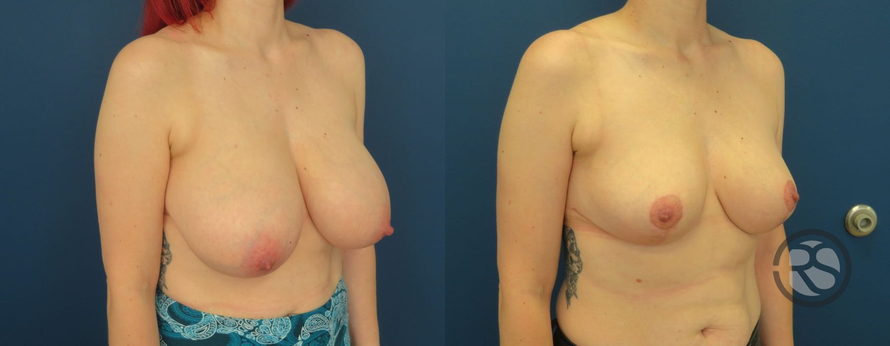 Before photo - Angle 2