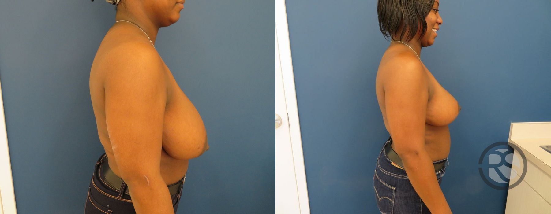 Before photo - Angle 3