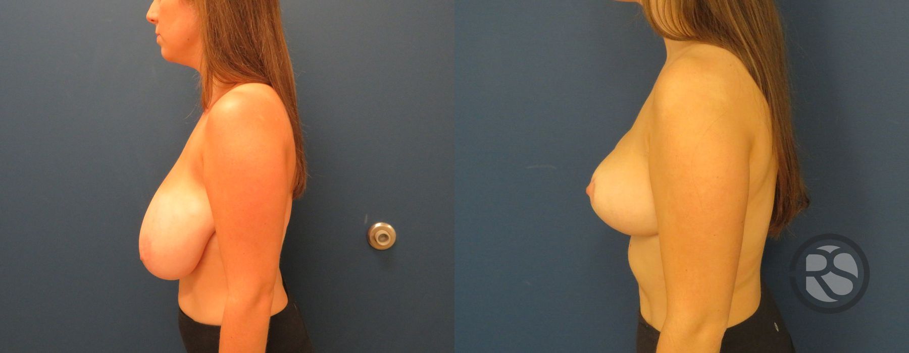 Before photo - Angle 5