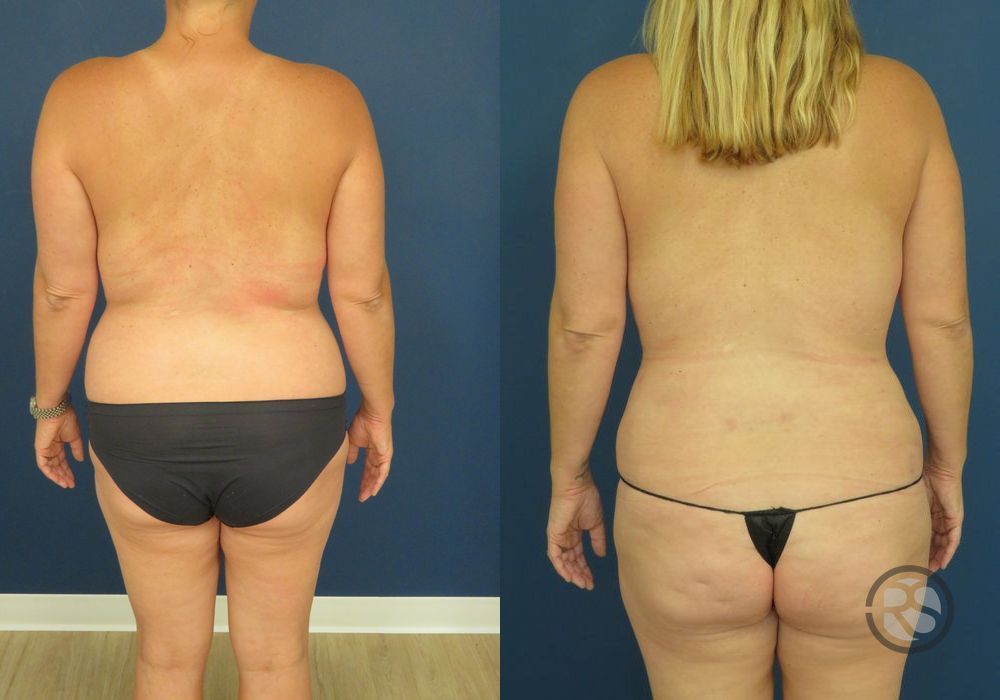 Before photo - Angle 6