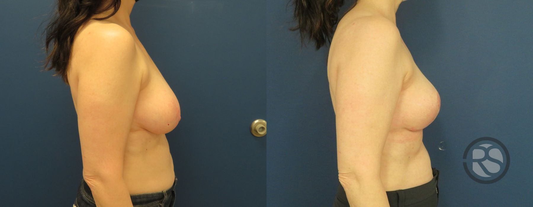 Before photo - Angle 5