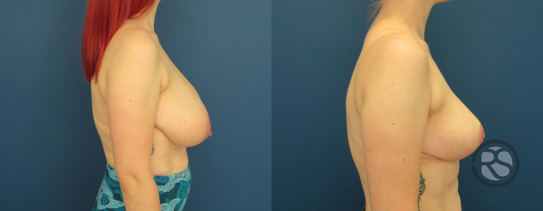 Before photo - Angle 3