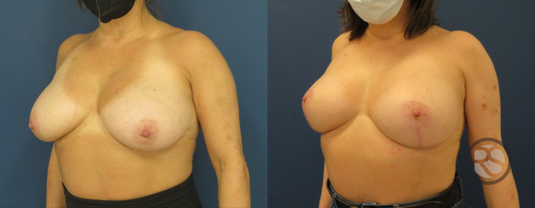 Before photo - Angle 2