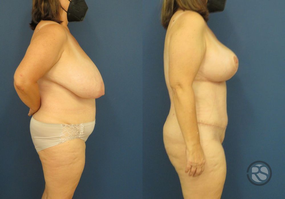 Before photo - Angle 3