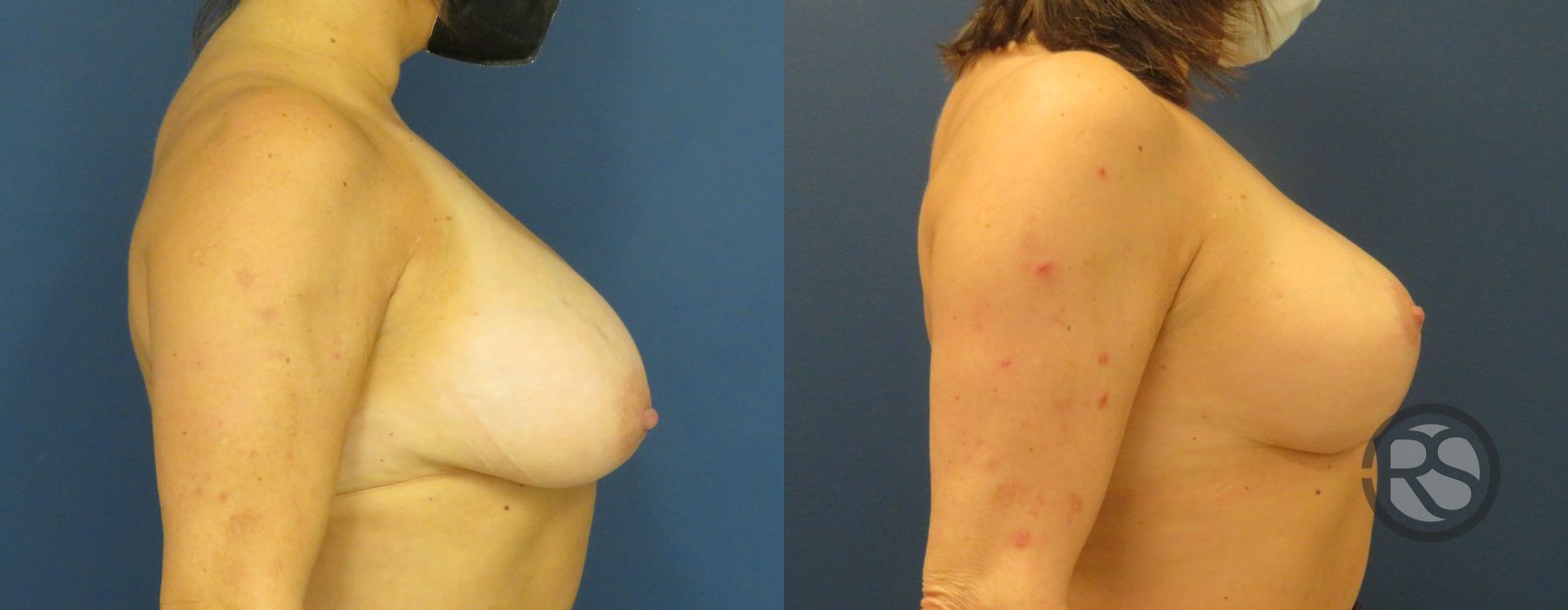 Before photo - Angle 5