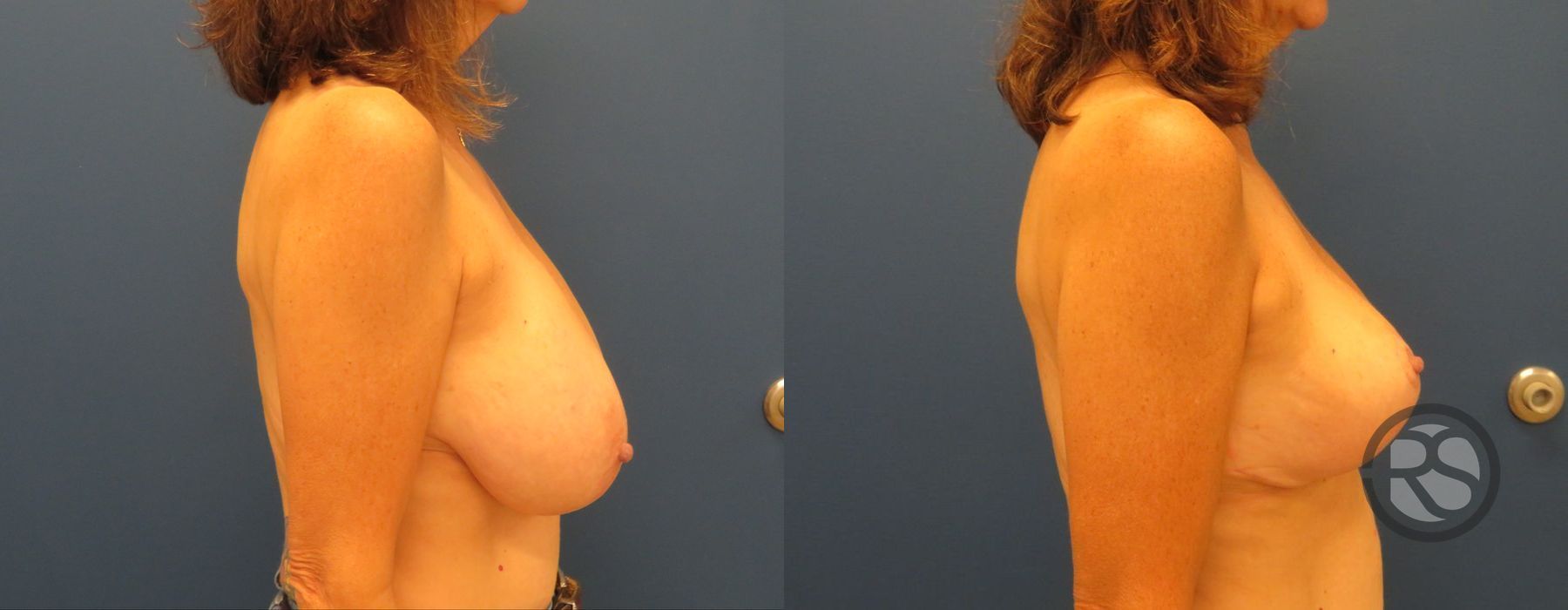 Before photo - Angle 3