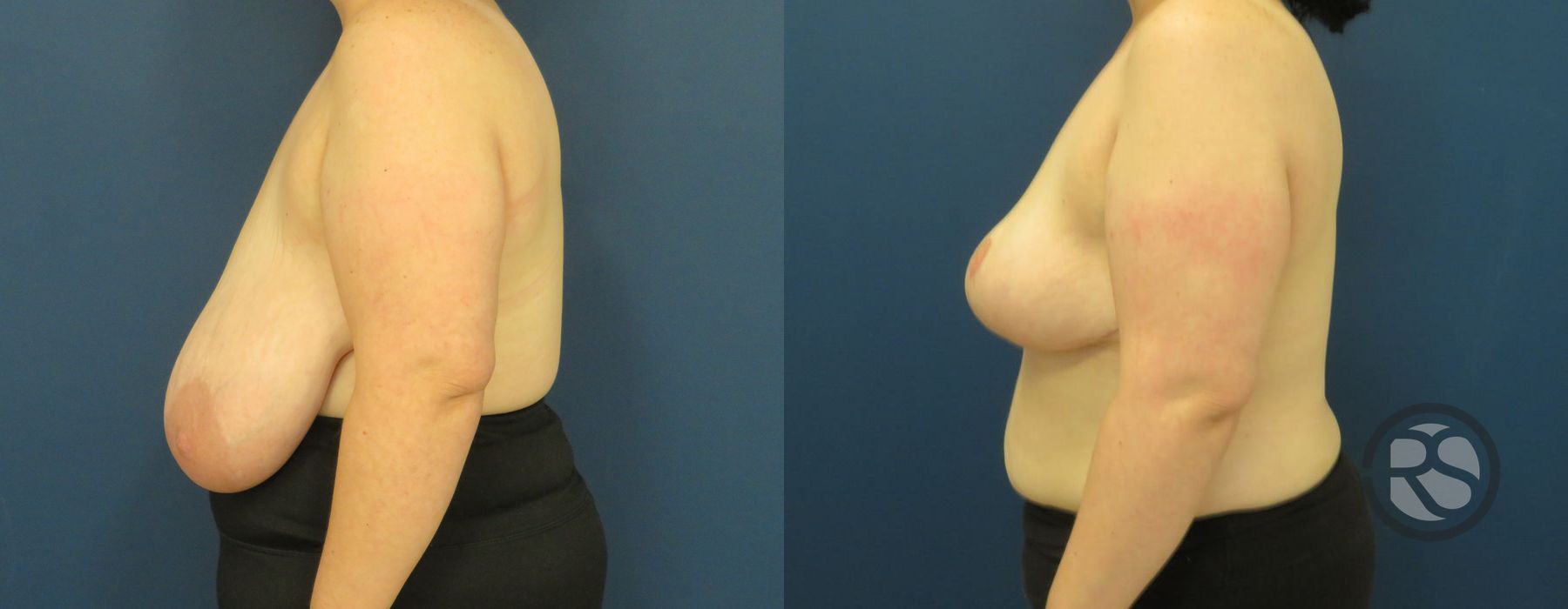 Before photo - Angle 5