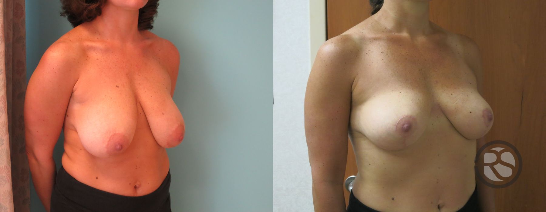 Before photo - Angle 2