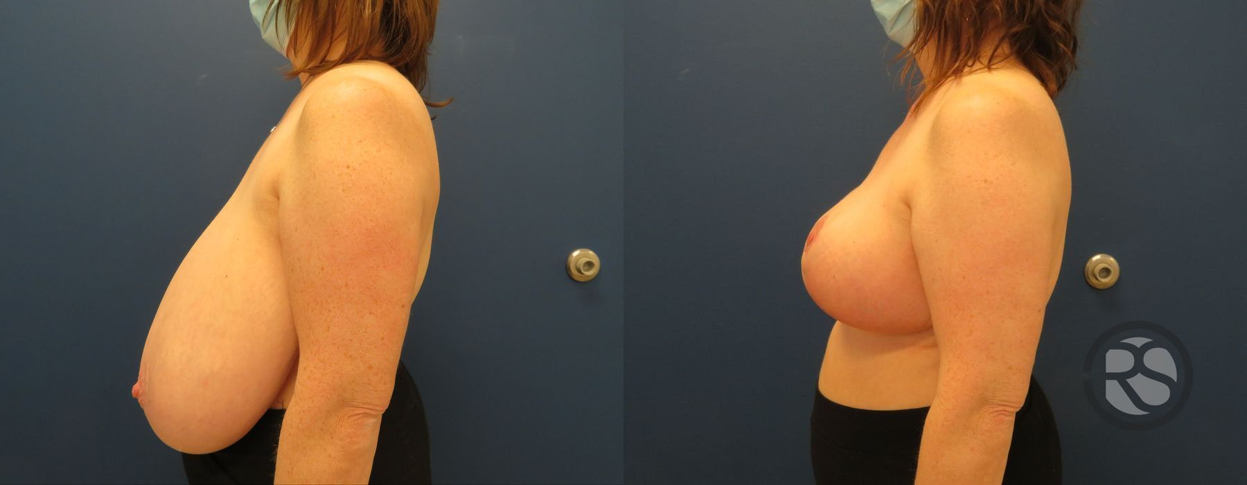 Before photo - Angle 5