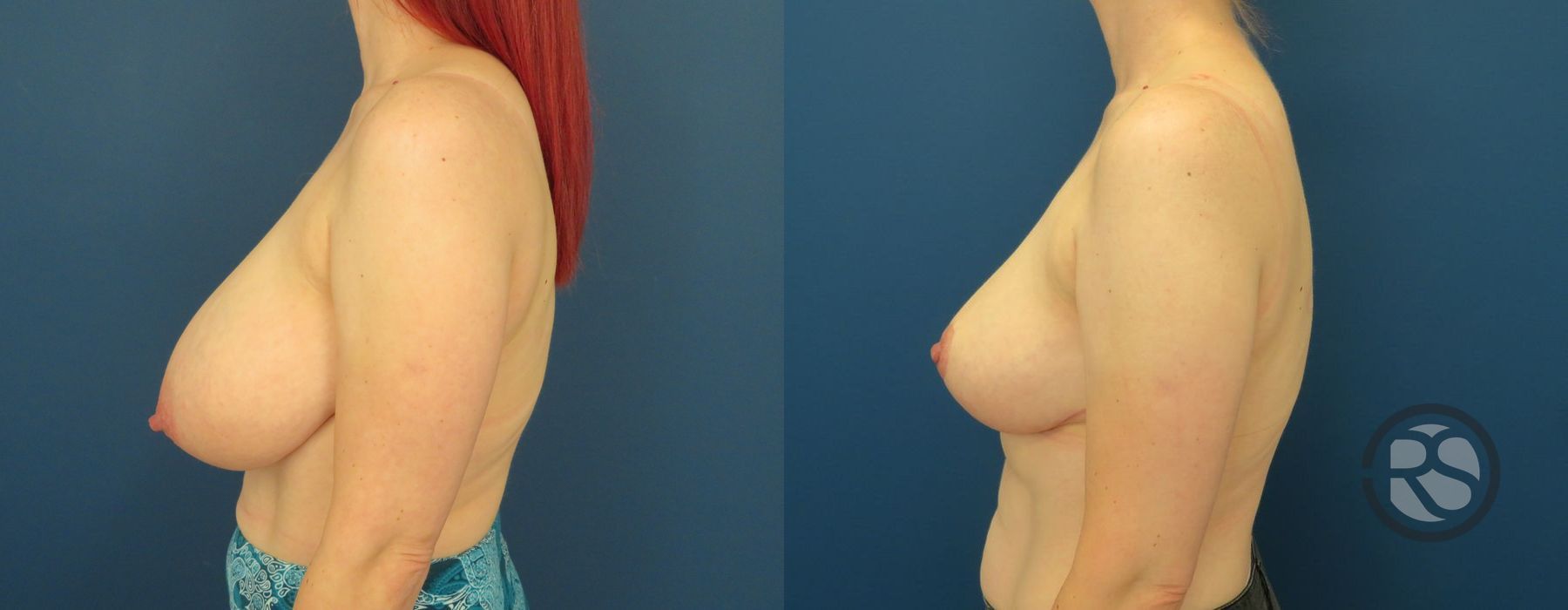 Before photo - Angle 5