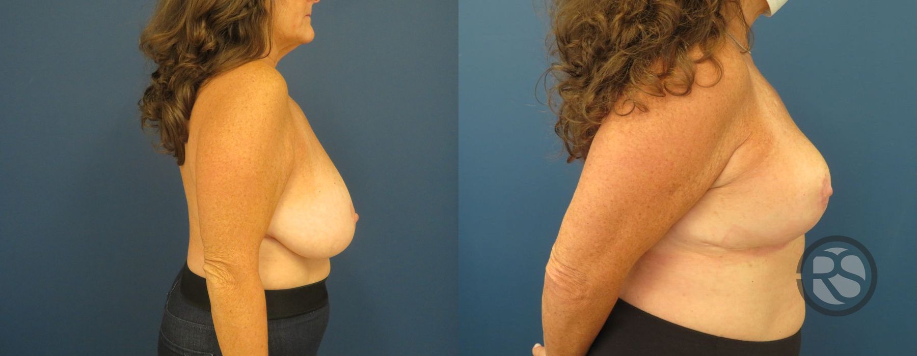 Before photo - Angle 5