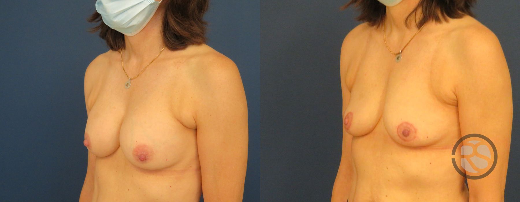 Before photo - Angle 2