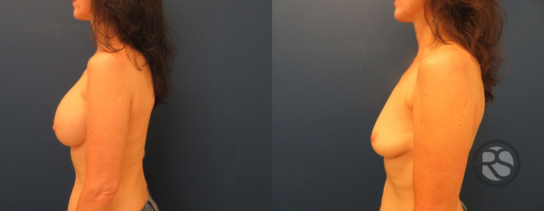 Before photo - Angle 5