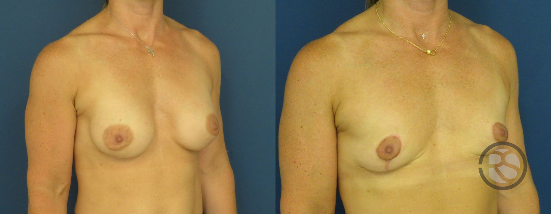 Before photo - Angle 2