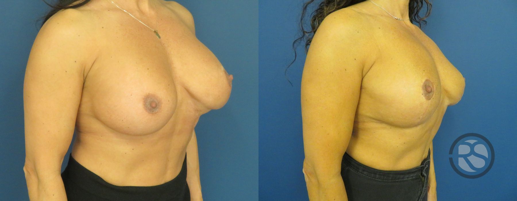 Before photo - Angle 2