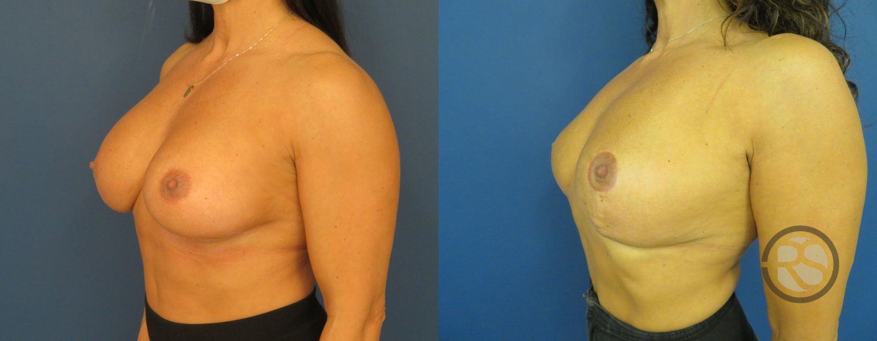 Before photo - Angle 4