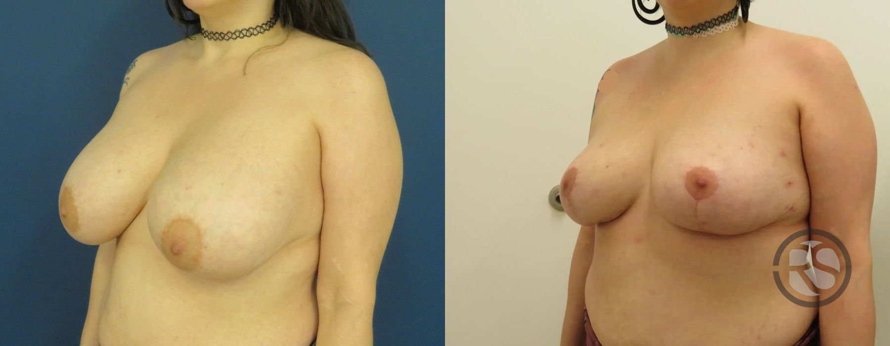 Before photo - Angle 4