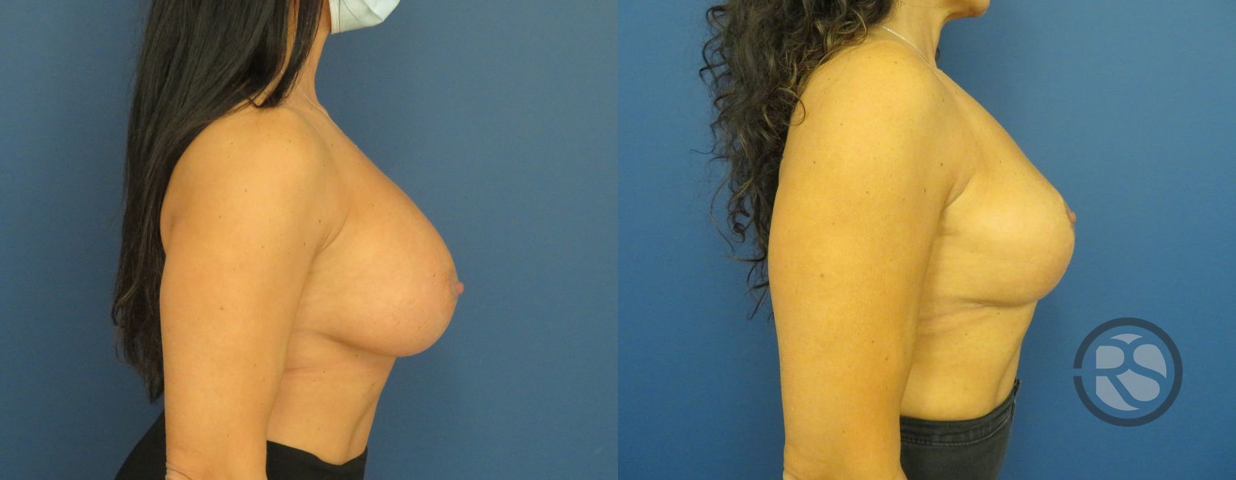 Before photo - Angle 3