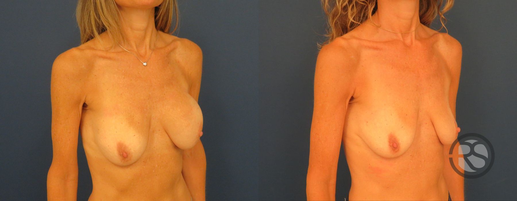 Before photo - Angle 2