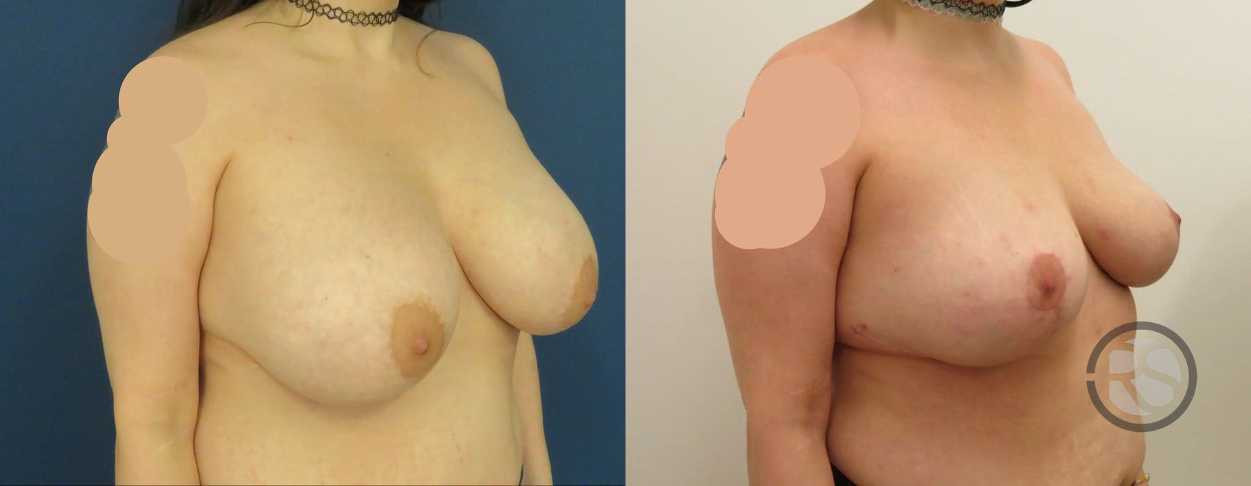 Before photo - Angle 2