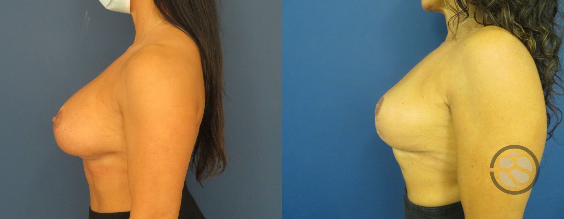 Before photo - Angle 5