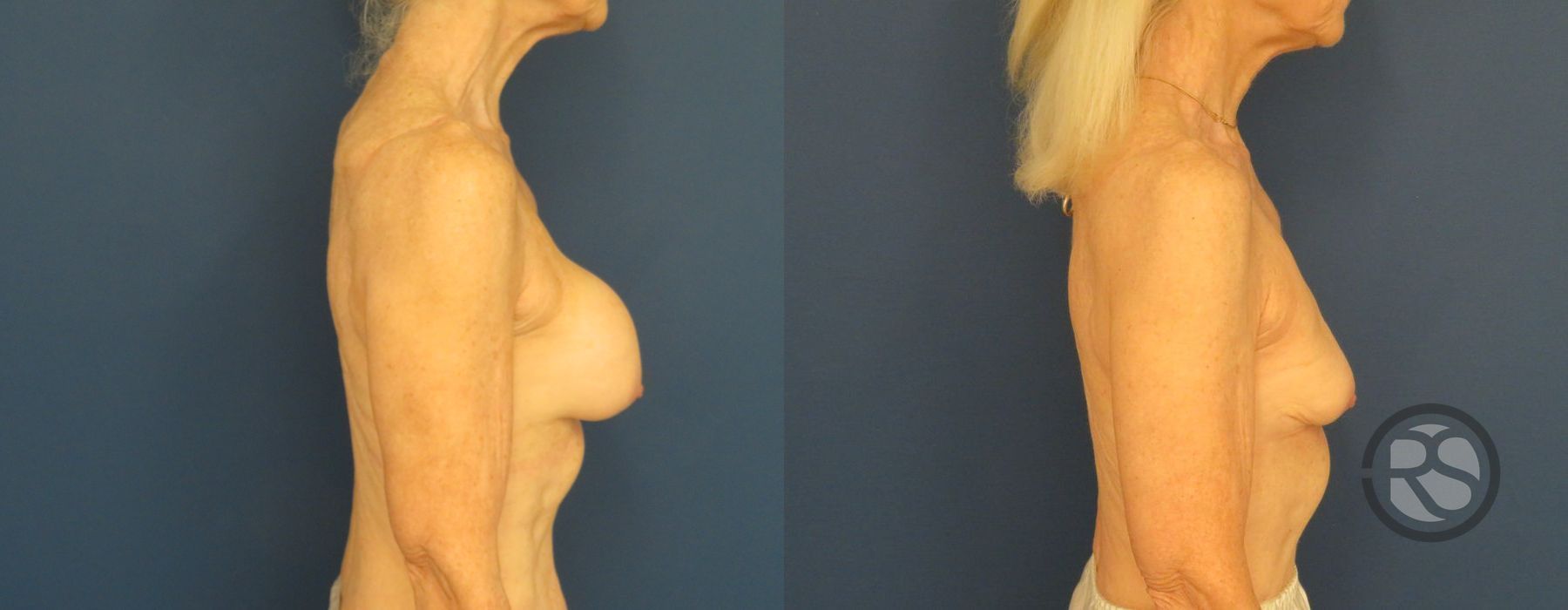 Before photo - Angle 3