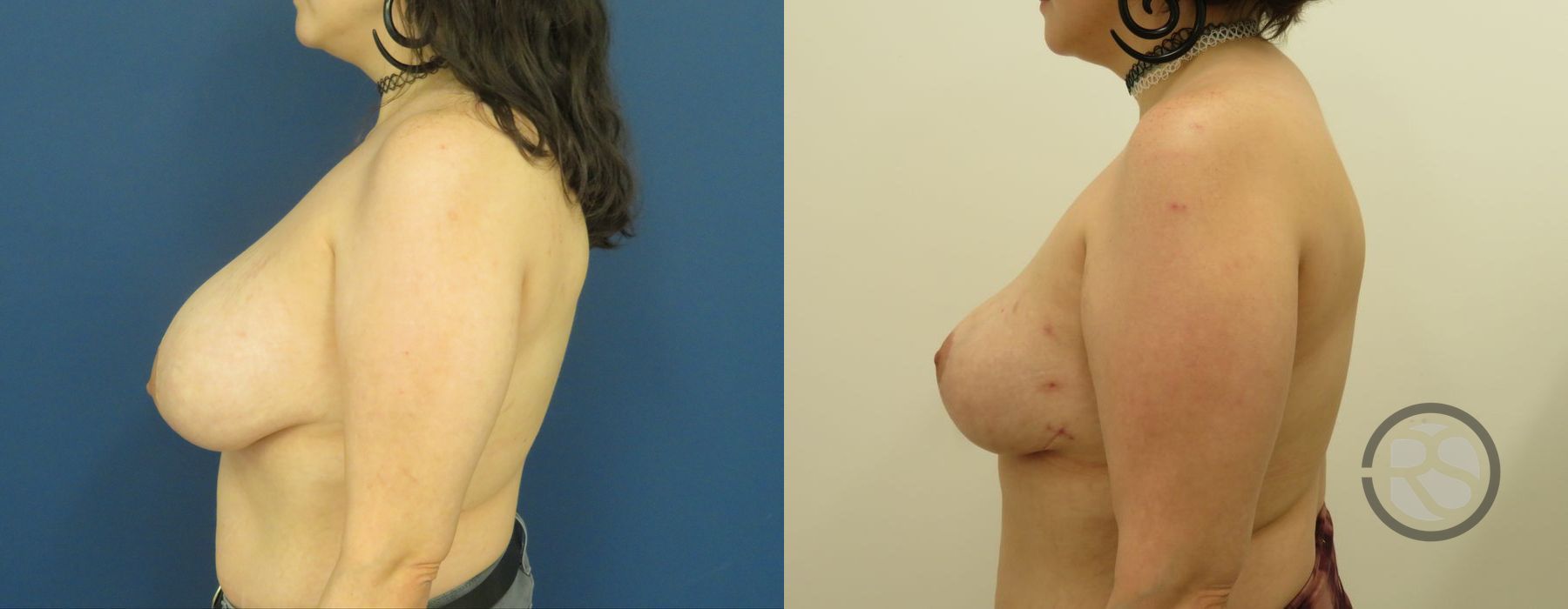 Before photo - Angle 5