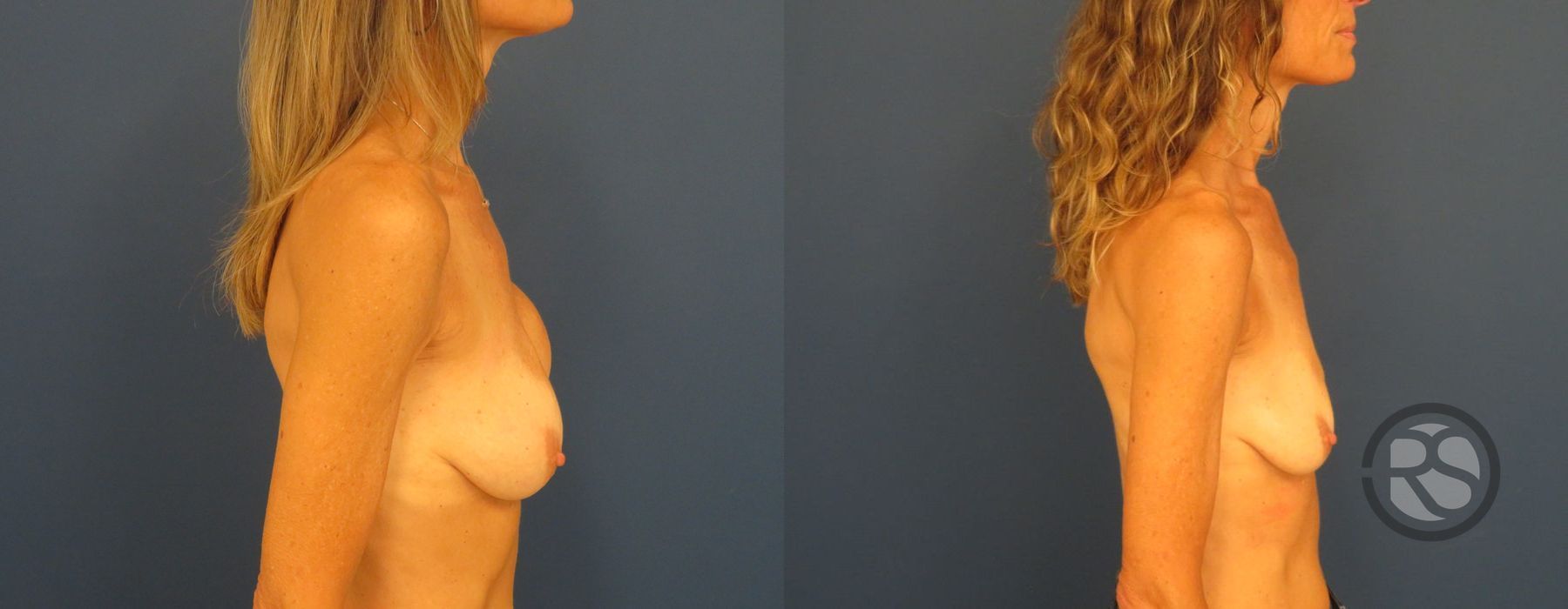 Before photo - Angle 3