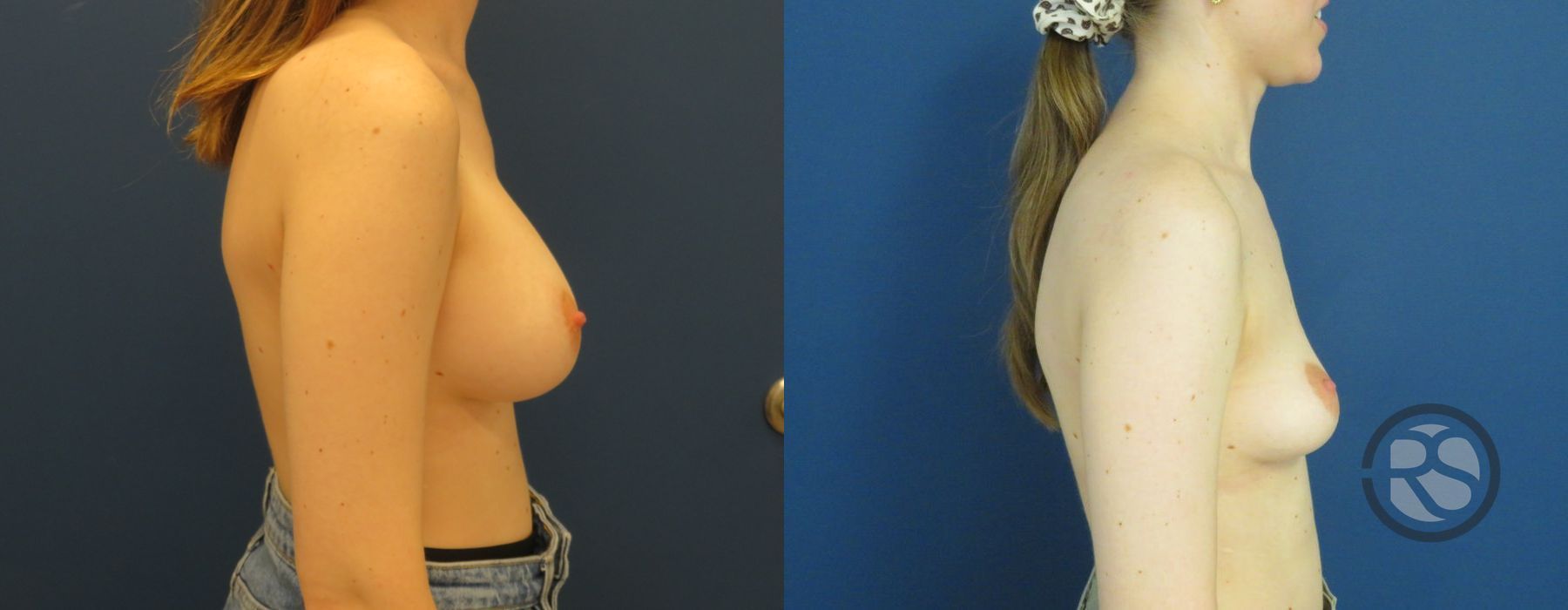 Before photo - Angle 3