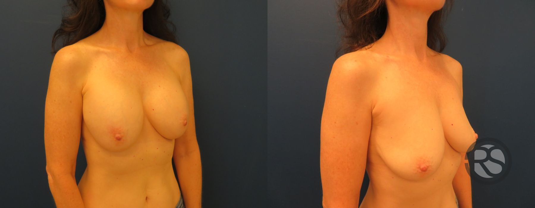 Before photo - Angle 2