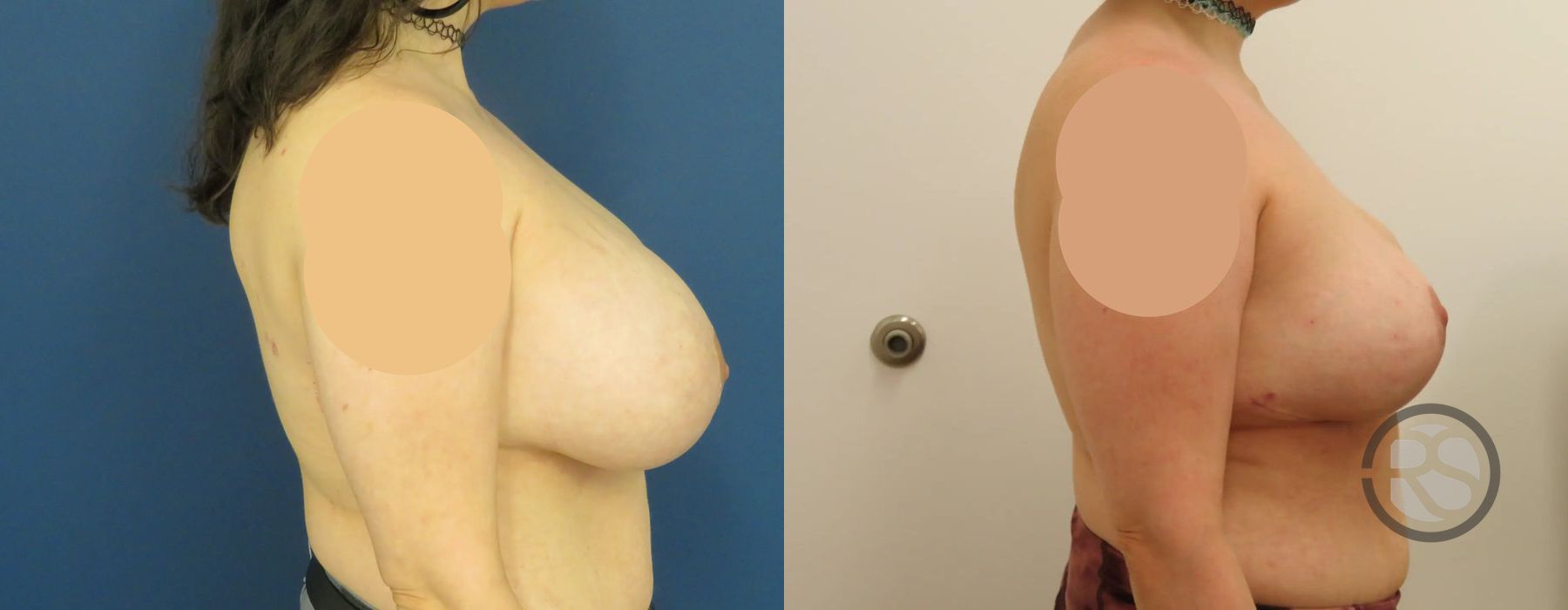 Before photo - Angle 3