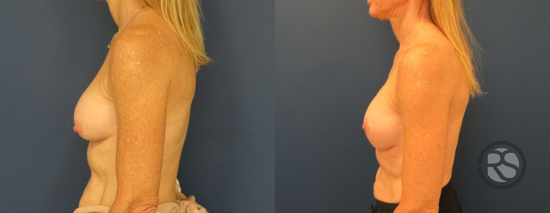 Before photo - Angle 5