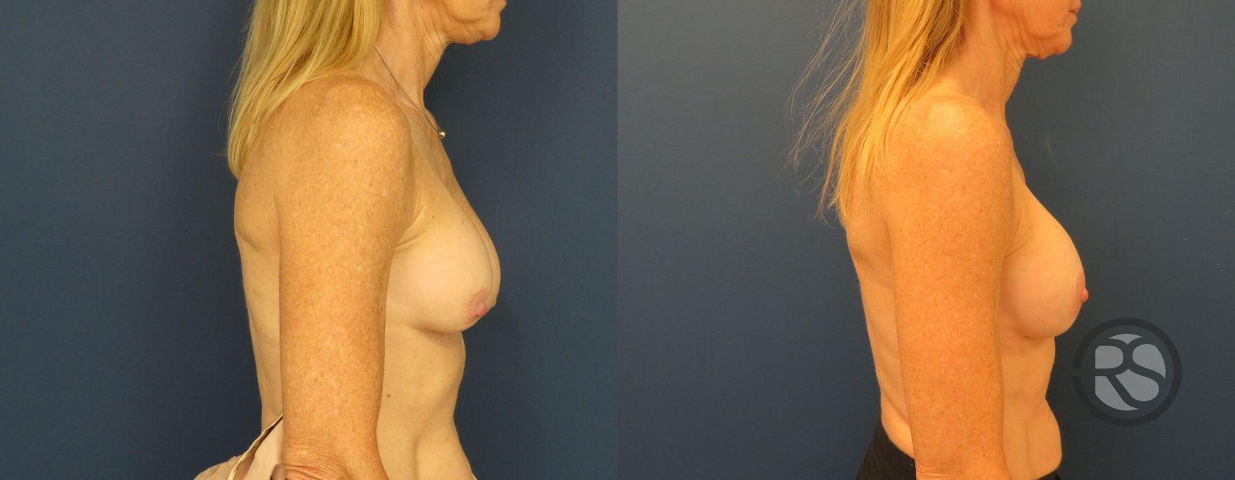 Before photo - Angle 3