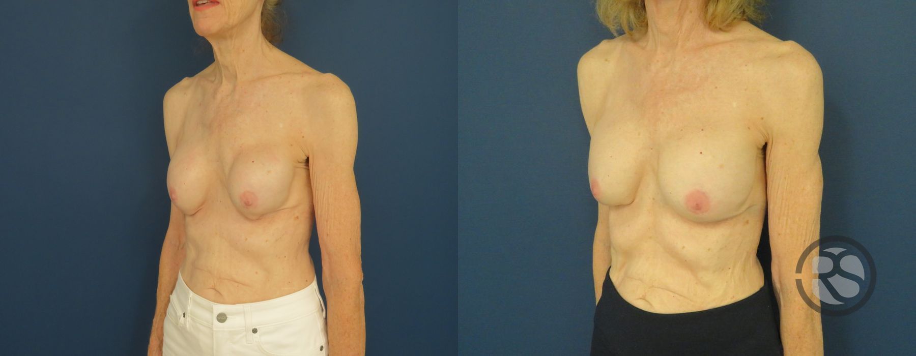 Before photo - Angle 3