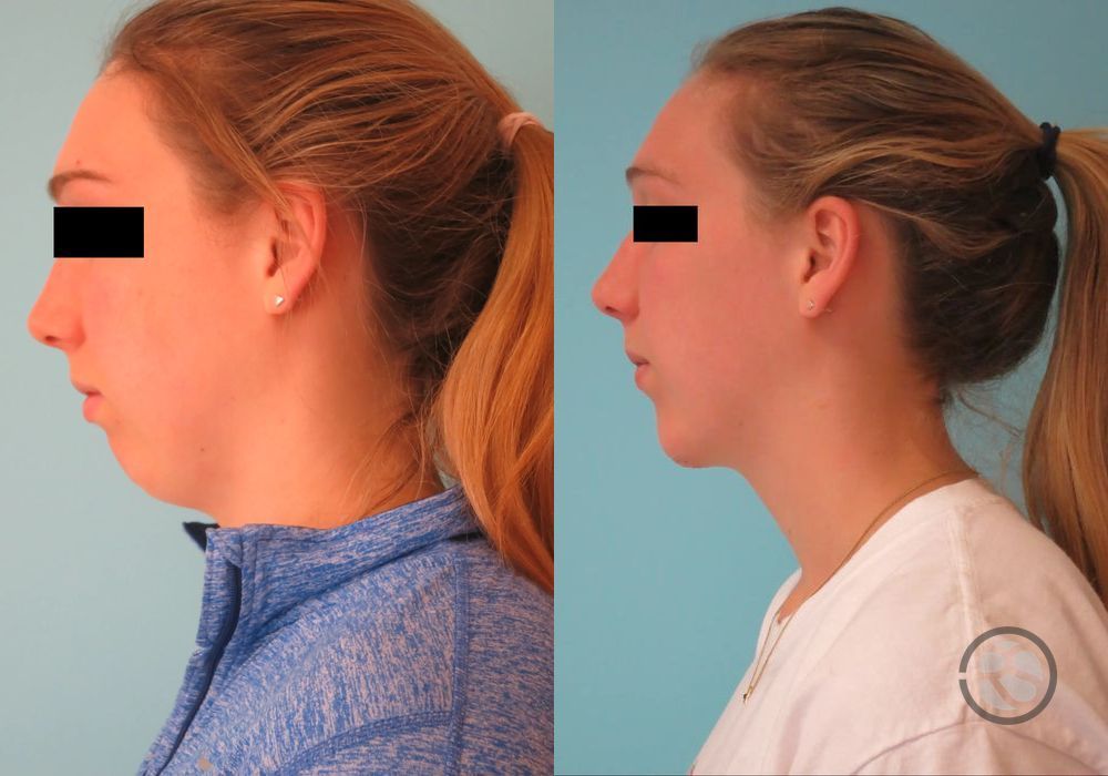 Before photo - Angle 5