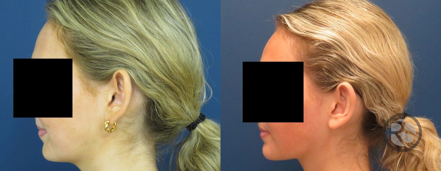 Before photo - Angle 3