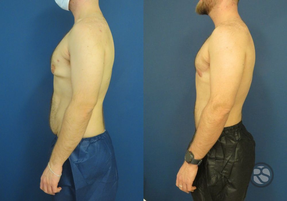 Before photo - Angle 3