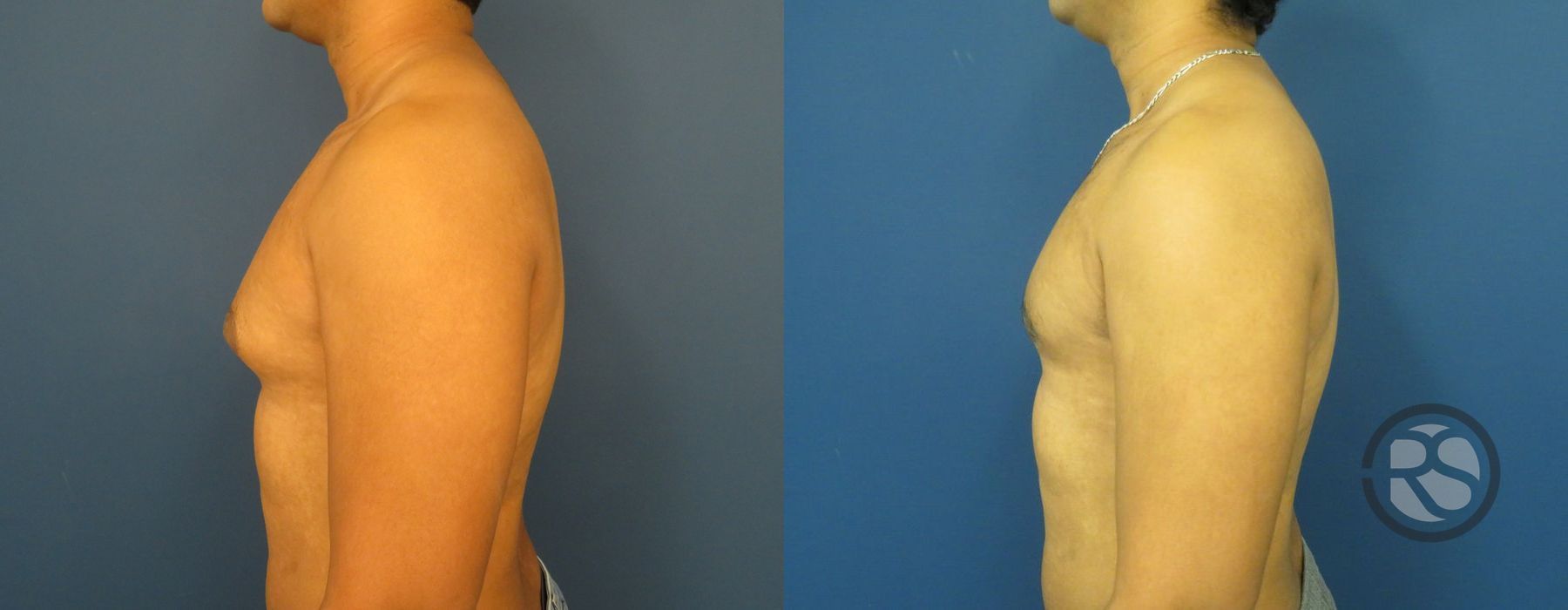 Before photo - Angle 5