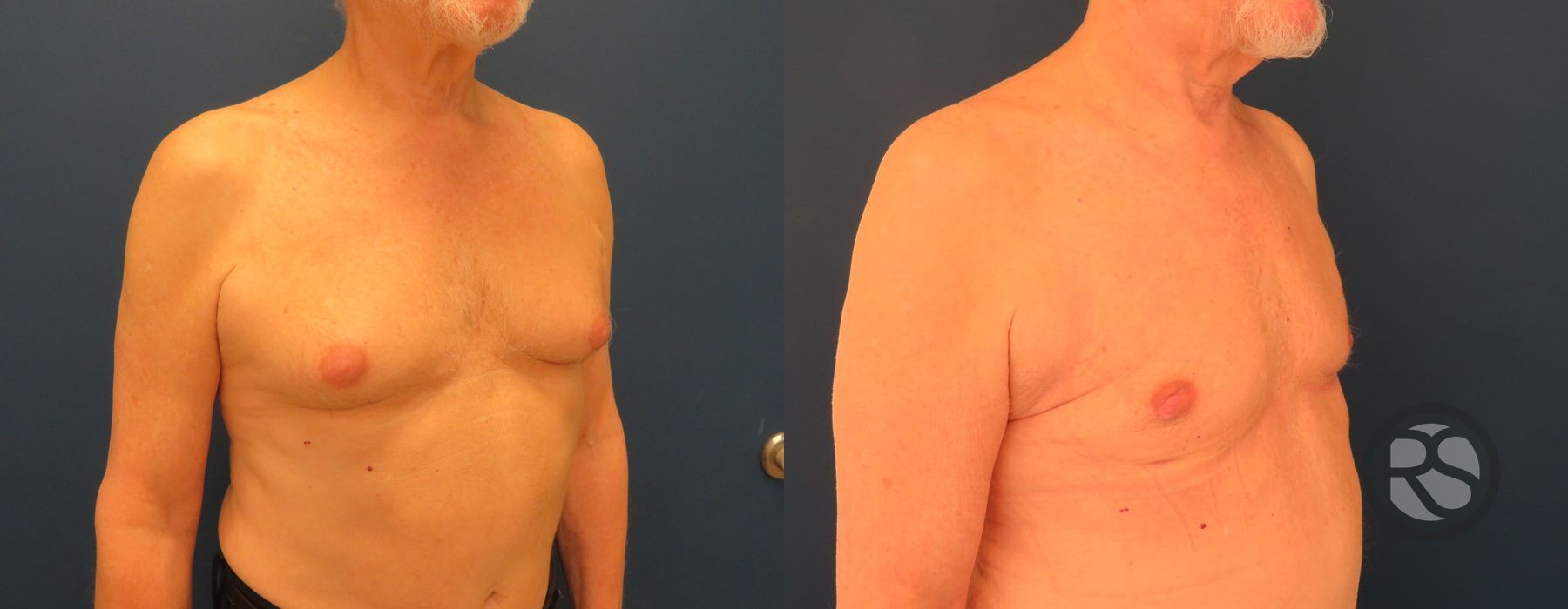 Before photo - Angle 3