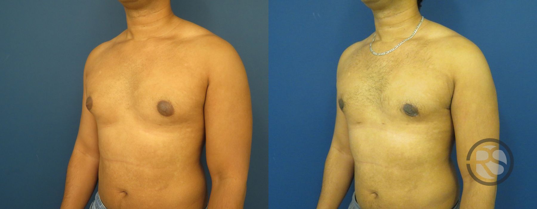 Before photo - Angle 4