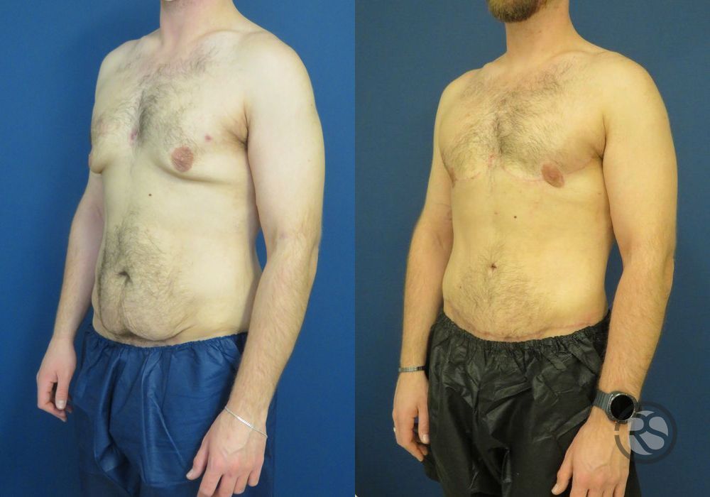 Before photo - Angle 2