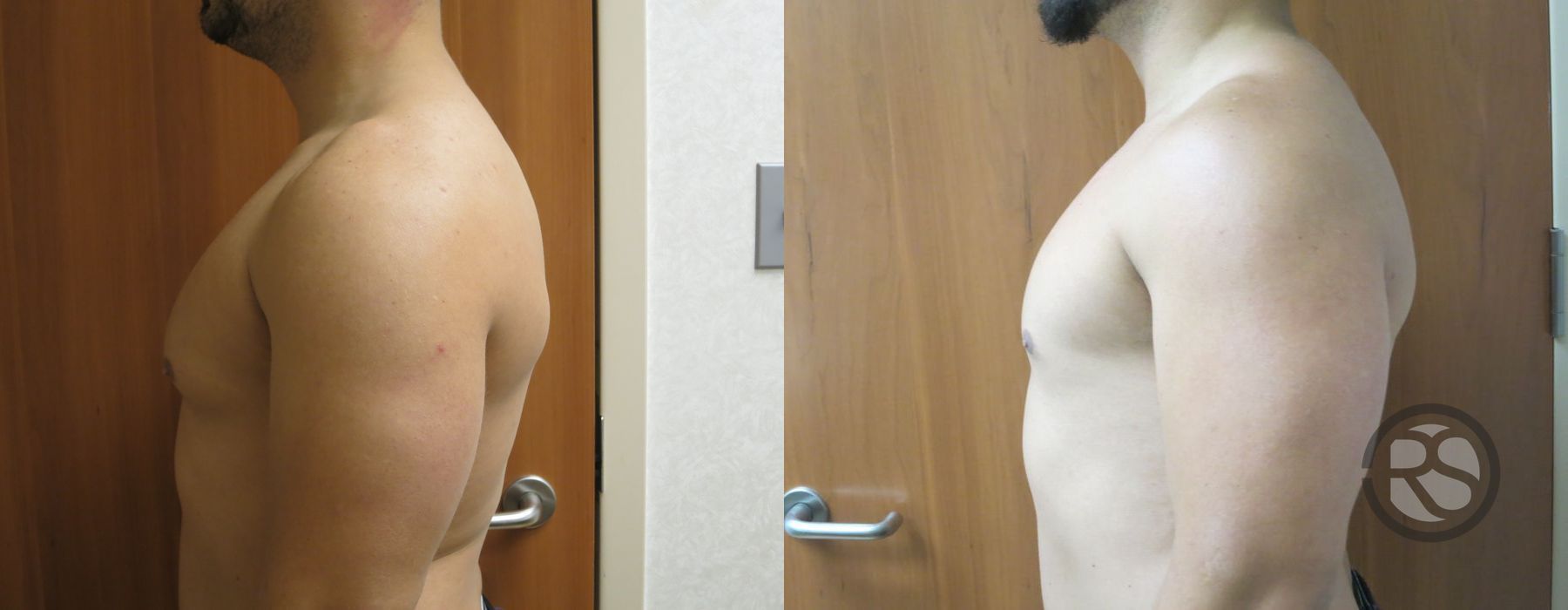 Before photo - Angle 5