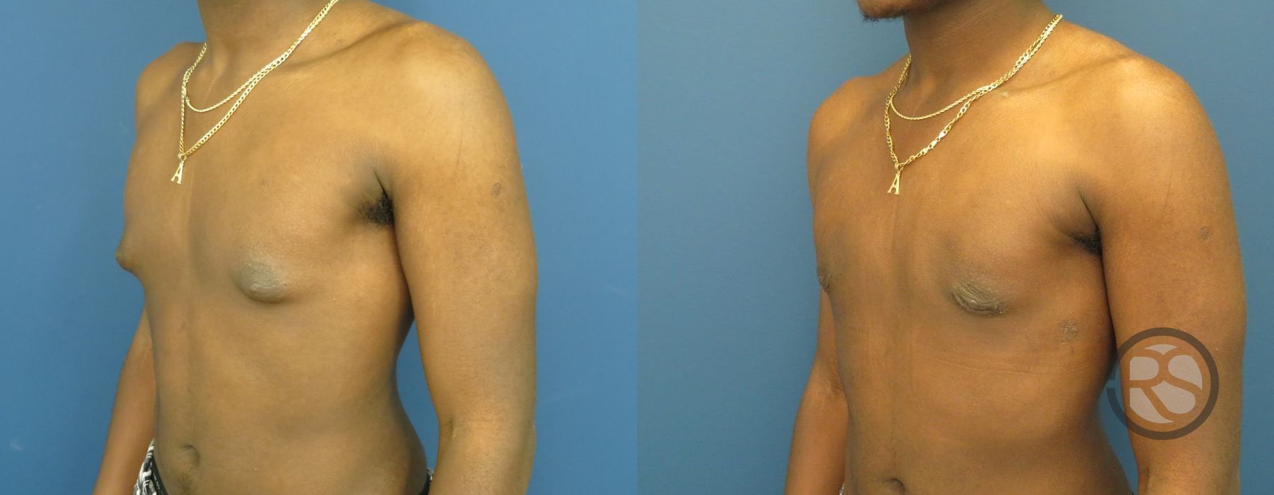 Before photo - Angle 4