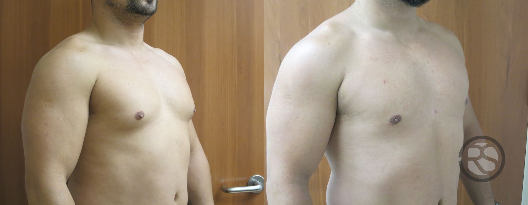 Before photo - Angle 2