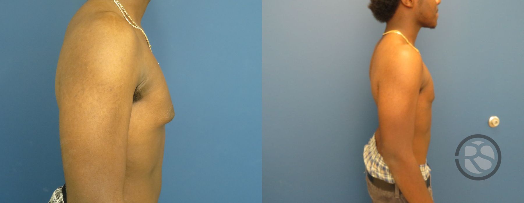 Before photo - Angle 3