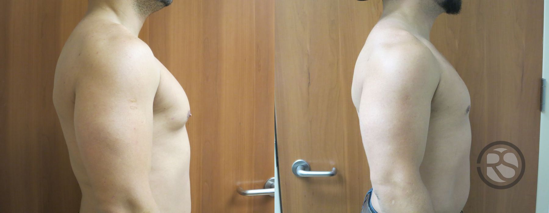 Before photo - Angle 3