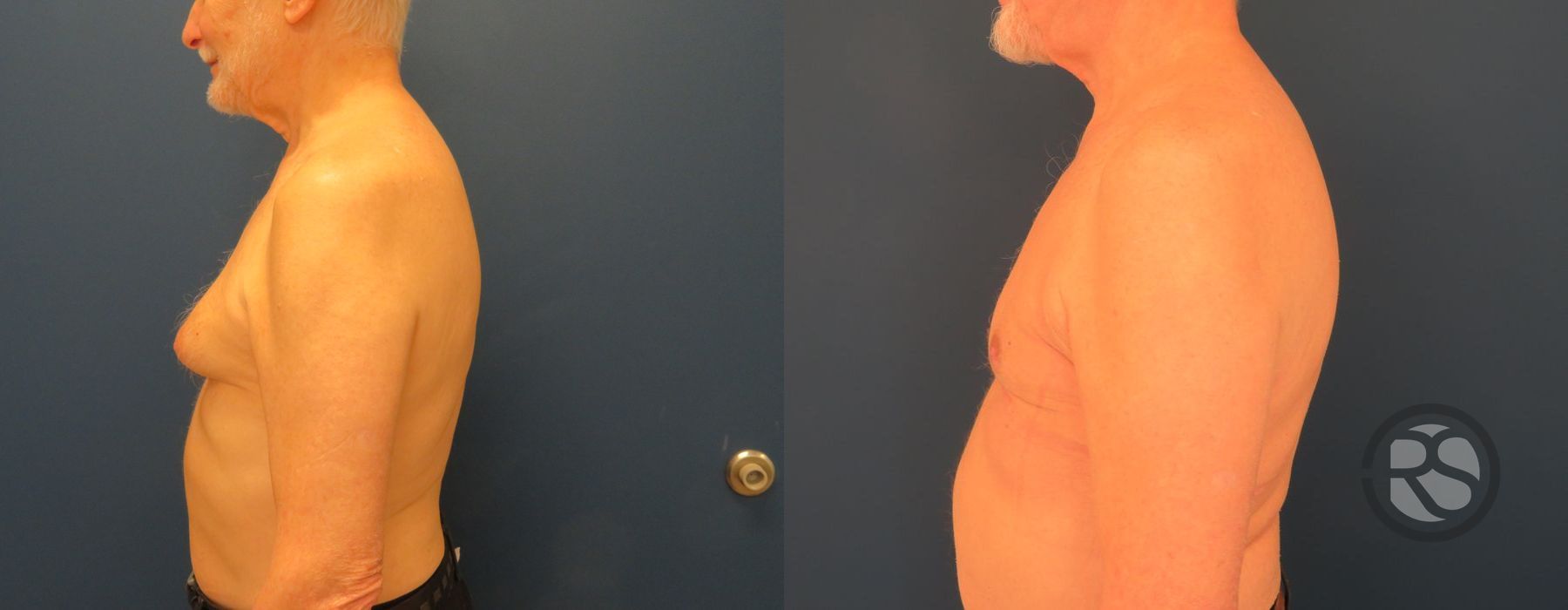 Before photo - Angle 4