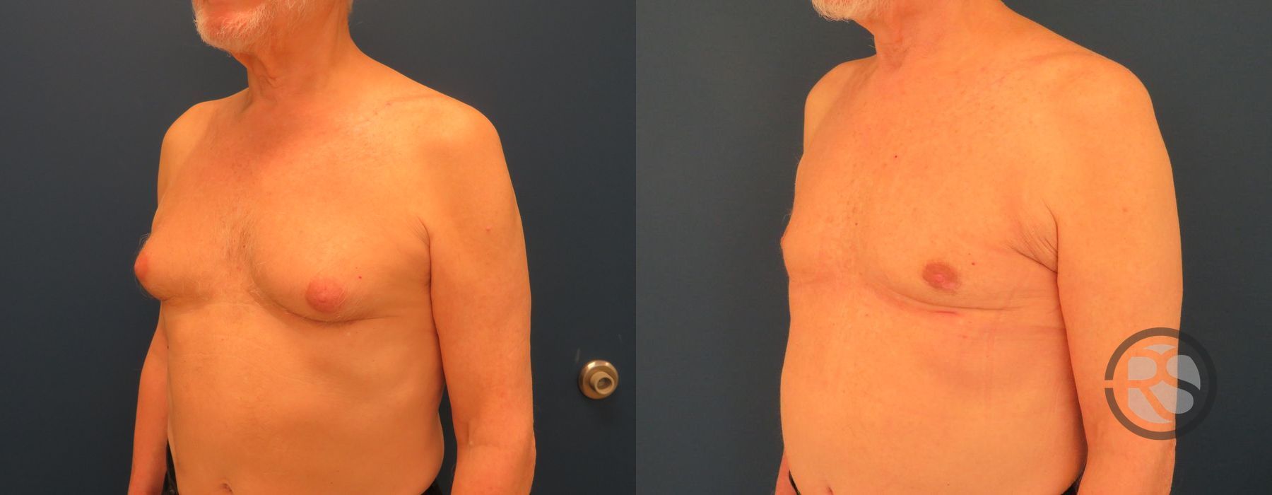 Before photo - Angle 5