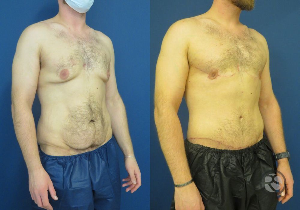 Before photo - Angle 4